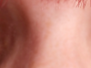 eyes